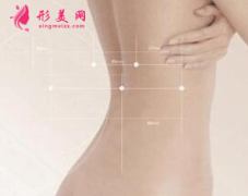 濟南市第一人民醫(yī)院整形科做背部吸脂疼痛感強嗎 無需縫合