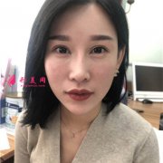 成都劉輔容眼整修與修復(fù)研究院眼部修復(fù)手術(shù)術(shù)后效果展示