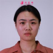 長(zhǎng)沙亞韓美容整形醫(yī)院鼻綜合手術(shù)恢復(fù)情況對(duì)比
