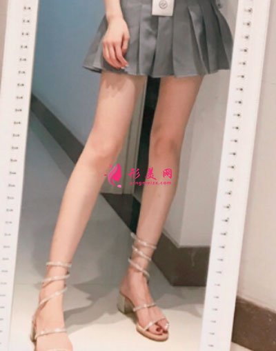 廈門安黛美醫(yī)療整形美容大腿吸脂案例
