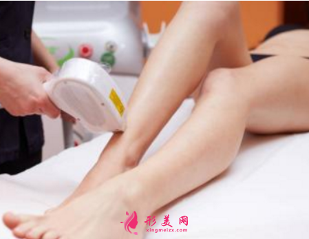 激光脫毛后要注意什么