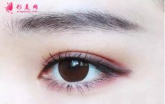 切開(kāi)雙眼皮的價(jià)格貴嗎？