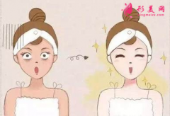 光子嫩膚后的效果好不好？