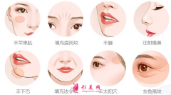 自體脂肪填充臉部什么時候消腫？