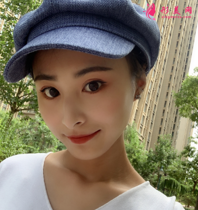 雙眼皮整形手術(shù)術(shù)后53天