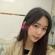 上海九院隆鼻+雙眼皮整形案例分享 術(shù)后80天效果對比圖