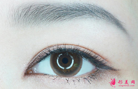 開(kāi)眼角術(shù)后的護(hù)理事項(xiàng)