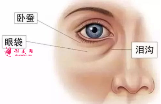 年輕人為什么會(huì)有眼袋