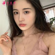 深圳富華醫(yī)療美容醫(yī)院注射瘦臉針后期效果反饋