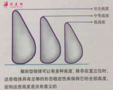 假體隆胸后吃什么比較好？