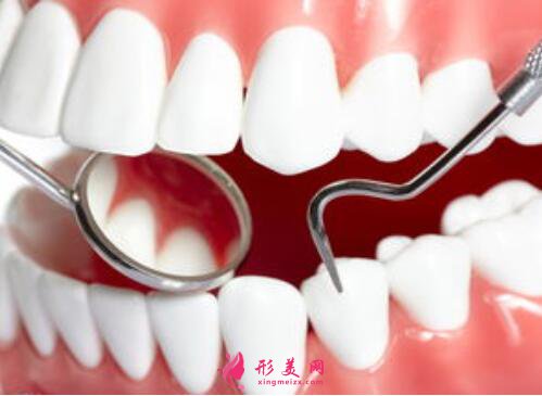 種植牙的價(jià)格費(fèi)用是多少