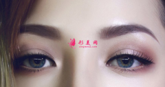 埋線雙眼皮怎么快速恢復(fù)？
