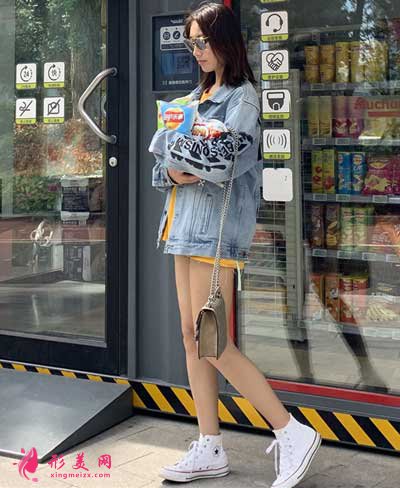 在成都米蘭柏羽整容醫(yī)院大腿抽脂手術(shù)15天后