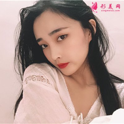 重慶面部線雕術(shù)后恢復(fù)情況對比
