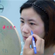 鄭州附二院鼻綜合手術(shù)術(shù)后恢復(fù)情況分享