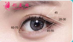 做開眼角手術(shù)后會回縮嗎？