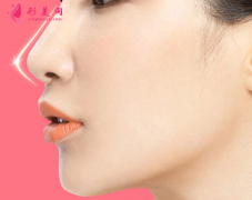 假體隆鼻后要怎么消腫？