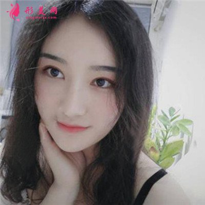 鄭州吸脂瘦臉術(shù)后恢復(fù)情況對(duì)比