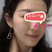 上海第九人民醫(yī)院熱瑪吉除皺半年后效果附圖 重返年輕