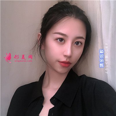武漢硅膠假體隆鼻術(shù)后恢復(fù)情況反饋