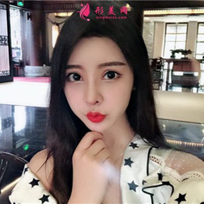 鄭州鼻綜合術(shù)后恢復(fù)效果對(duì)比