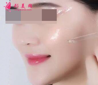 臉上打了玻尿酸要注意什么