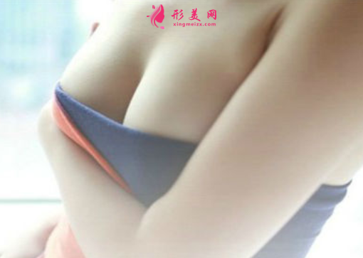 假體隆胸后多久可以進(jìn)行日?；顒?dòng)