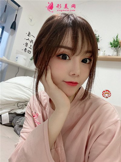 鄭州做M唇手術術后恢復效果反饋 術后 鄭州做M唇手術術后恢復效果反饋