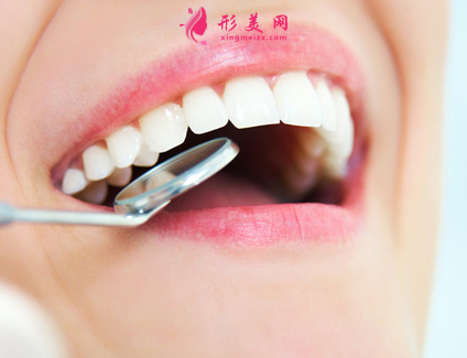 做烤瓷牙的價格是多少