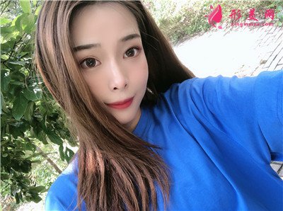 上海切開雙眼皮術(shù)后恢復(fù)情況反饋