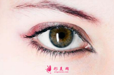 做開眼角手術(shù)什么時(shí)候能恢復(fù)