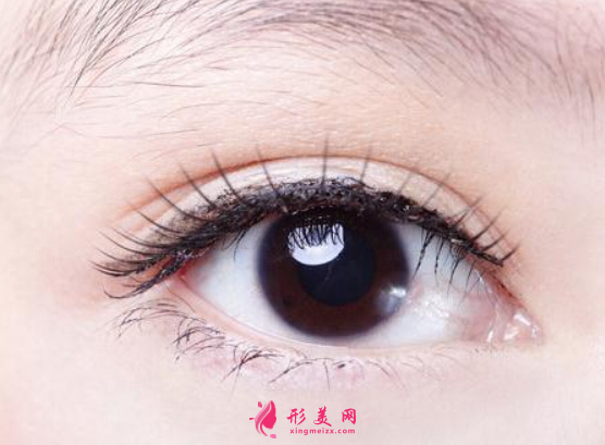 做開眼角手術(shù)什么時(shí)候能恢復(fù)