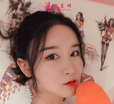 上海華美醫(yī)療美容醫(yī)院V-LINE瓜子臉手術案例