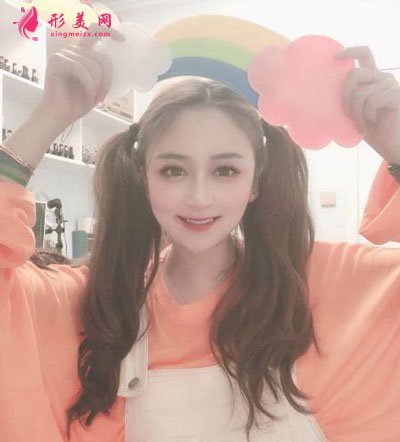 杭州瑞麗整形美容醫(yī)院隆鼻案例