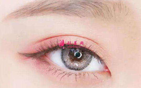 做開(kāi)眼角的注意事項(xiàng)