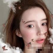 北京大學(xué)深圳醫(yī)院整形外科價(jià)格表，附雙眼皮案例