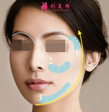自體脂肪填充臉部有什么優(yōu)勢嗎