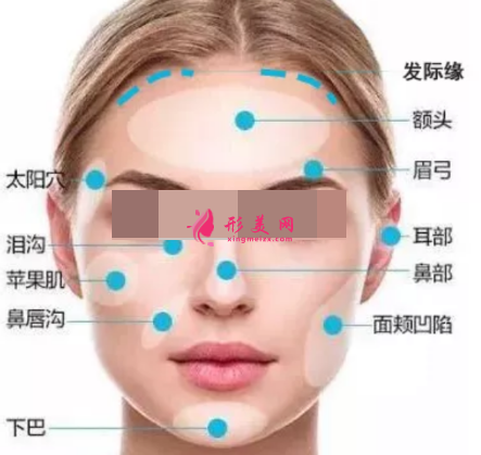 自體脂肪填充臉部會有后遺癥嗎