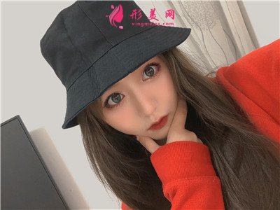 昆明切開雙眼皮術(shù)后恢復(fù)情況分享