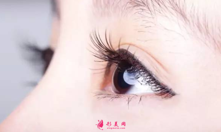 全切雙眼皮的價(jià)格是多少