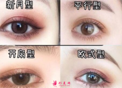 雙眼皮術(shù)后多少天變得自然？