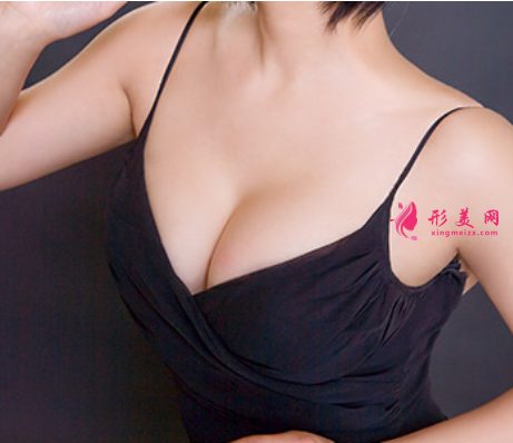 假體隆胸安全么