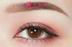 開眼角后怎么護(hù)理？