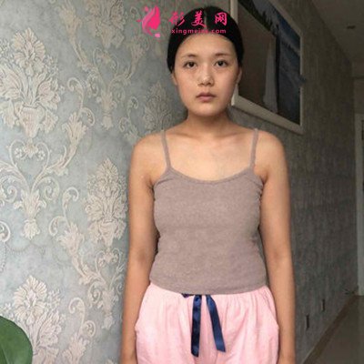 北京假體隆胸術(shù)后恢復(fù)效果反饋