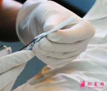 假體隆鼻感染了會(huì)出現(xiàn)什么癥狀