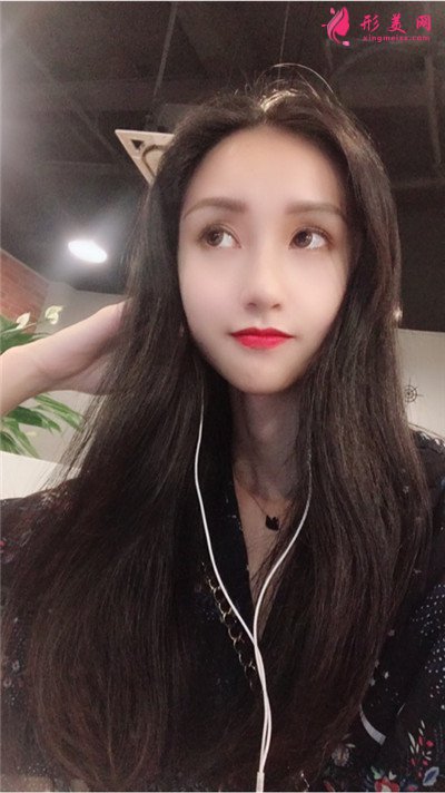 武漢發(fā)際線種植手術(shù)術(shù)后恢復(fù)效果分享
