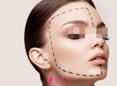 自體脂肪填充臉部?jī)r(jià)格跟什么因素有關(guān)