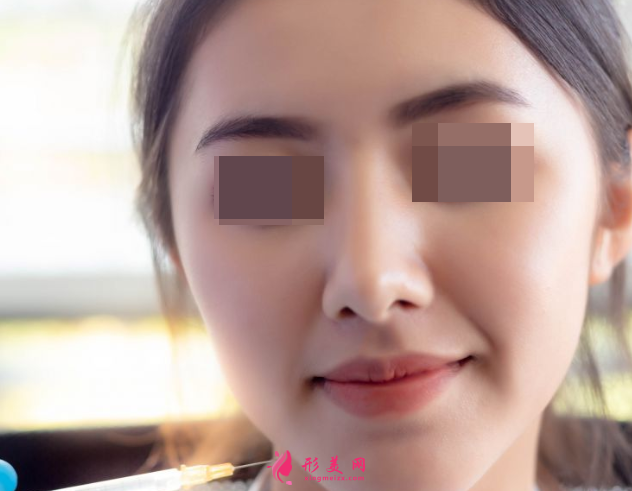 自體脂肪填充臉部多少天可以恢復(fù)好