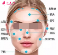 自體脂肪填充臉部多少天可以恢復(fù)好