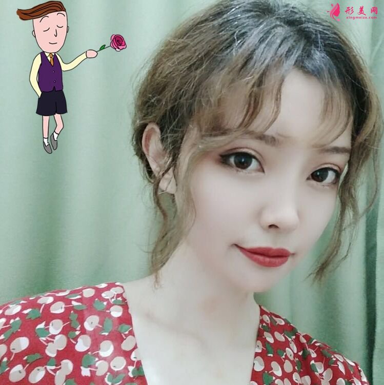 術后三十五條,自體脂肪